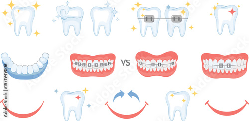 Teeth Whitening and Braces Comparison Illustration with Before and After Smile, Orthodontic Treatment and Dental Aesthetic Care Concepts