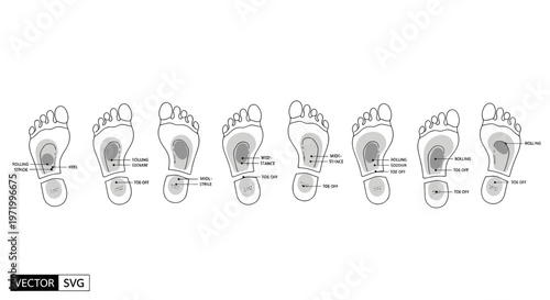 Foot Pressure Distribution Chart: Pronation, Supination, and Neutral Arches