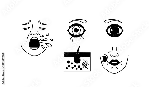 Allergy reaction icon collection vector illustration