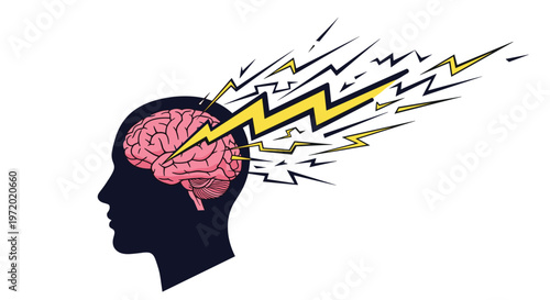 Human head silhouette with a detailed brain and yellow lightning bolts flashing out representing a migraine, stress, or a sudden stroke of genius.