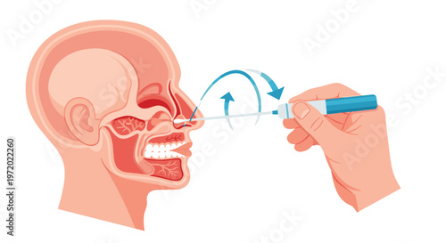 Medical cross section diagram of a human head showing a nasal swab being inserted for a respiratory virus test.