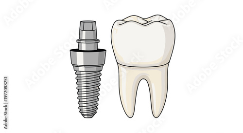 A side-by-side comparison shows a grey titanium screw-like dental implant next to a natural white molar tooth with two distinct roots in a clean space.