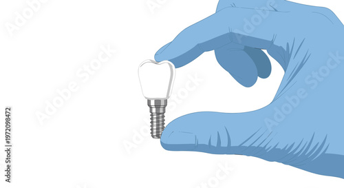 A professional hand wearing a blue medical glove carefully holds a realistic dental implant with a white porcelain crown against a bright white backdrop.