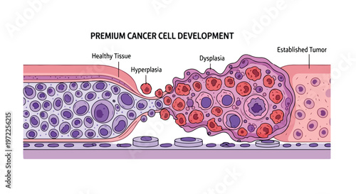 Diagram illustrating the progression of cancer cell development from healthy tissue to an established tumor