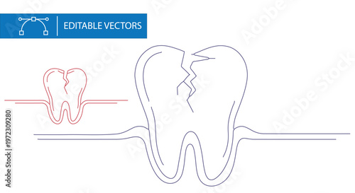 Broken tooth line art vector, cracked molar with gum line illustration, dental pain and tooth decay concept, editable outline stroke graphics