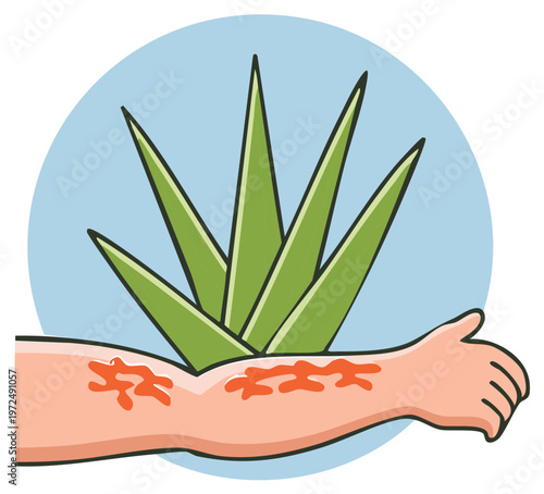 Aloe vera plant providing natural relief for irritated skin on a human arm illustration