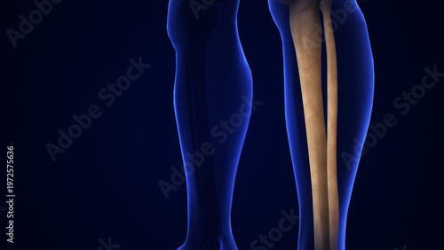 Photos Broken Fibula Bone Pain Anatomy Medical Concept
