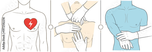 First Aid and CPR Procedure Illustration Set with Heart Pain Chest Compression and Medical Help Vector Collection