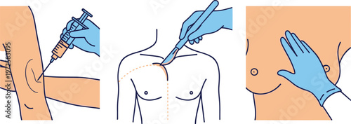 Plastic Surgery Procedures Line Illustration Set with Injection Shoulder Marking and Breast Examination Medical Vector Collection