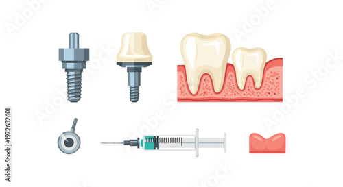 Highly detailed dental implant diagrams showcase a cross-section of the human jawbone alongside a medical syringe and various prosthetic abutment pieces.