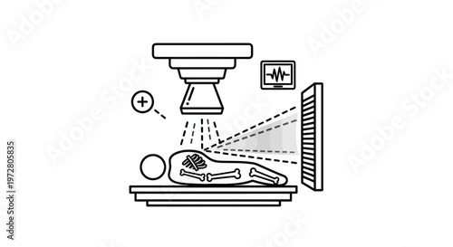 Medical X-ray Imaging Illustration: Patient on Table Under Scanner