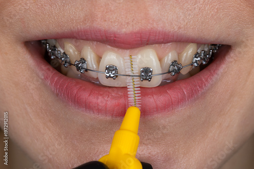  Dental hygiene concept