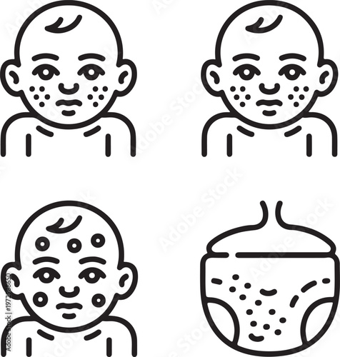 Four outline icons depicting various stages of skin rash on a babys face and also diaper irritation
