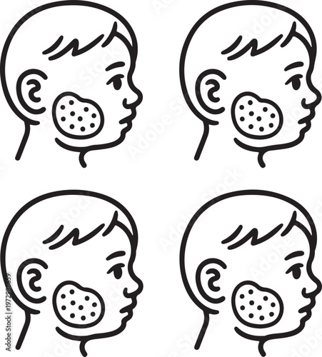 Line icon illustrations of a childs head in profile showing inflammation or swelling on the cheek area