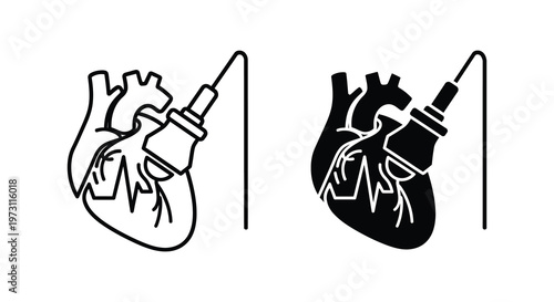 Medical procedure depicting a heart with a device black and white silhouette