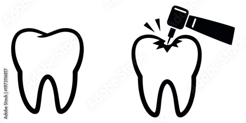 Line art dental icon set featuring a healthy tooth and a tooth being drilled for oral health concepts