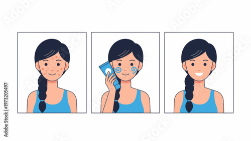 Acne treatment skincare process vector showing before and after
