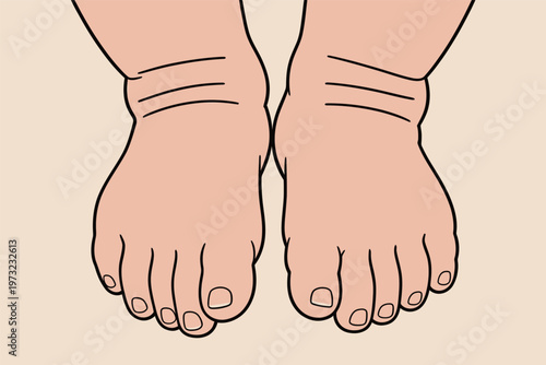 Illustration of Human Feet with Wrinkles
