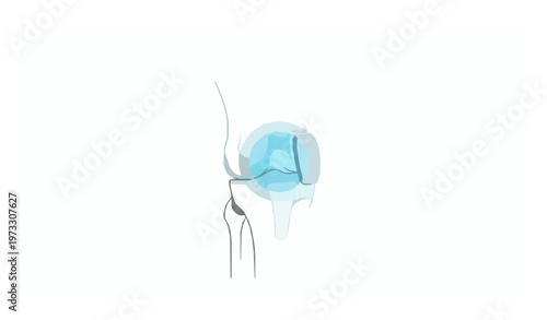 Knee Osteoarthritis Pain Futuristic Medical Scan Blue Neon Vector