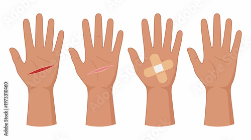 An illustration showing various stages of hand injuries and healing, emphasizing the importance of care and recovery through visual storytelling of human experiences.