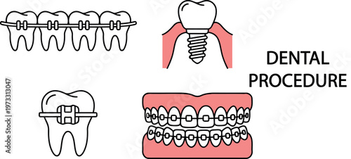 Dental health icons depicting braces implants and a single tooth on transparent background