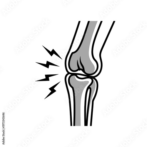 Illustration of knee joint experiencing electric shock or pain sensation