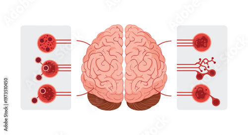 A detailed medical illustration displays a human brain in pink tones with several red circular callouts highlighting various microscopic neurological and cellular structures.