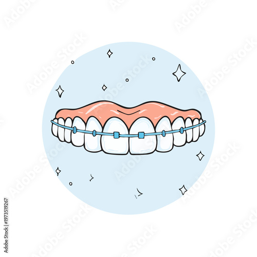 Illustration of straight white teeth with blue orthodontic braces and sparkling highlights