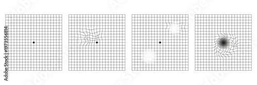 Set of amsler grid, medical test