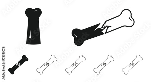 Broken bone illustration with varying line styles and perspectives shown