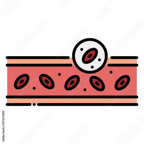 Extravasation: Blood Vessel Leakage Vector Illustration