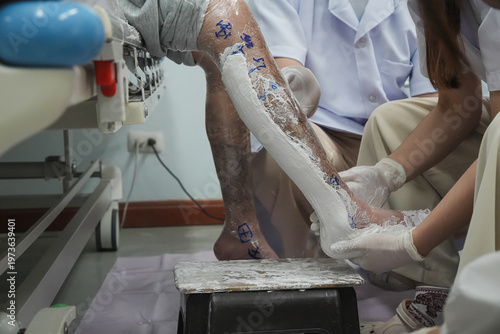 Prosthetist making a plaster cast of a patient's leg for a custom Ankle Foot Orthosis (AFO). Professional orthotic fitting process in a rehabilitation clinic.