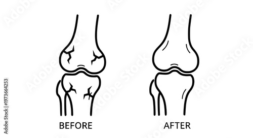 Joint Recovery Before After Vector with Injury and Healing Comparison
