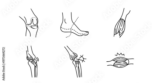 Sports Injury Vector Icons with Knee Sprain and Ligament Damage