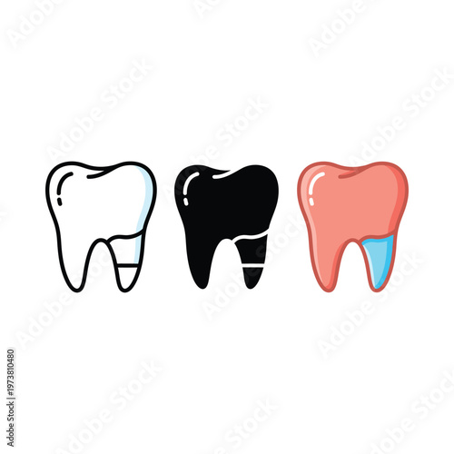 Illustrations of a tooth in different stages of dental treatment and decay