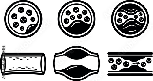 Blood flow and artery blockage stages