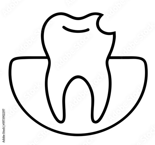 Deep Tooth Cavity on Chewing Surface, Dental Caries Damage and Filling Treatment
