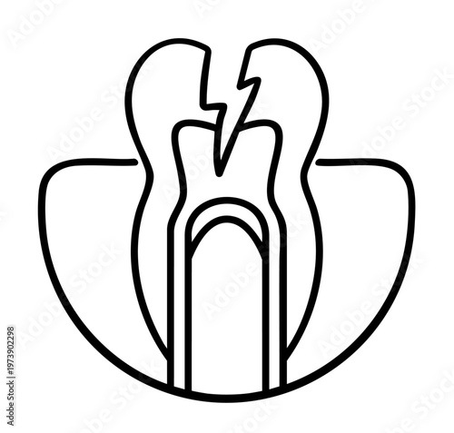 Pulpitis with Nerve Inflammation, Root Canal Endodontic Treatment and Tooth Preservation