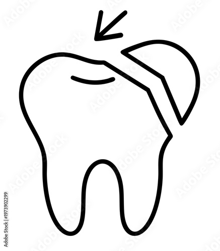 Tooth Crown Fracture with Broken Fragment, Dental Trauma Damage and Restoration Treatment
