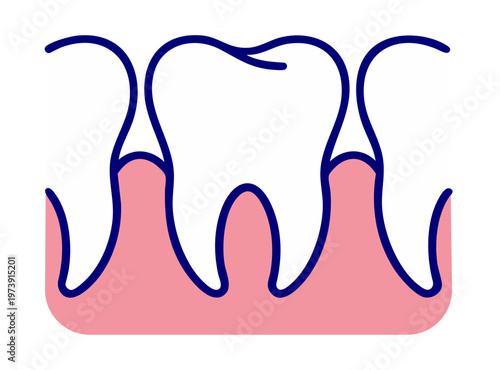 Tooth Gap Spacing Condition, Diastema Between Teeth in Gum, Dental Alignment Problem