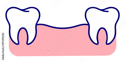 Missing Tooth Gap After Extraction, Empty Space in Gum After Tooth Removal, Dental Loss and Implant Need
