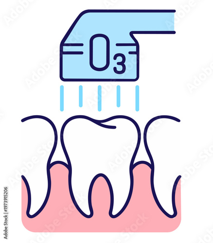 Dental UV Light Curing Filling Treatment, Ultraviolet Lamp Hardening Composite Resin on Tooth in Gum
