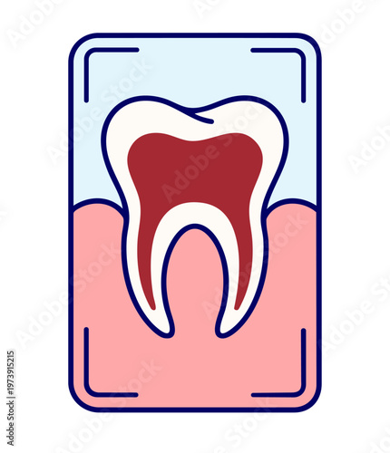 Dental X Ray Scan Showing Tooth Structure Roots and Internal Diagnosis for Hidden Problems Detection