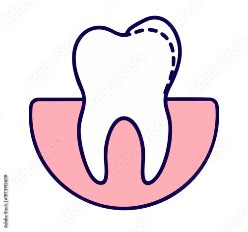Tooth contouring with enamel reshaping — smoothing uneven edges for perfect symmetry, cosmetic dentistry