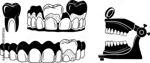 Comprehensive Dental Illustration Set Featuring Human Molar Anatomy Gum Disease Progression Gingivitis Stages Professional Orthodontic Articulator Model and Tooth Restoration Elements for Dentistry