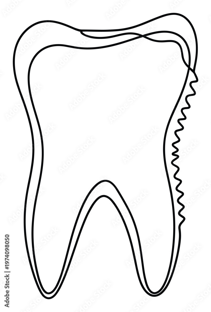Obraz premium Outline of a human tooth depicting signs of enamel erosion or decay, perfect for dental clinic advertisements, educational content about oral care, and health awareness campaigns.