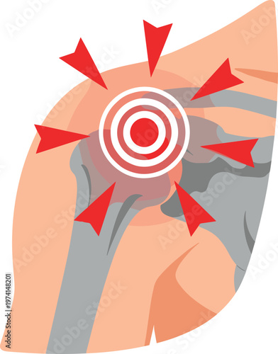 Human shoulder joint pain red arrows indicating discomfort and inflammation healthcare medical graphic.