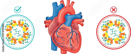 Cholesterol good vs bad concept, heart health illustration, HDL LDL comparison, cardiovascular disease risk, healthy diet, medical infographic, artery care