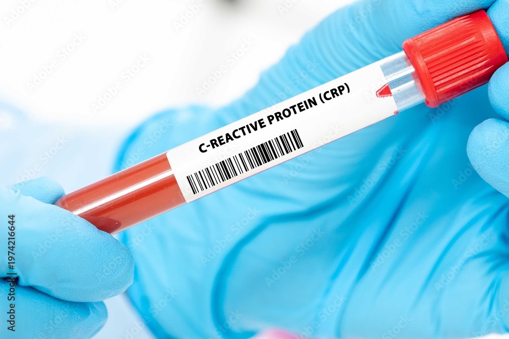Fototapeta premium C-Reactive Protein (CRP)
