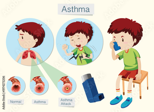 World Asthma Day Awareness Illustration